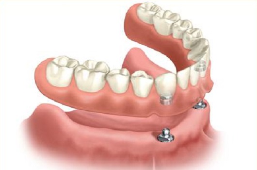 1456546