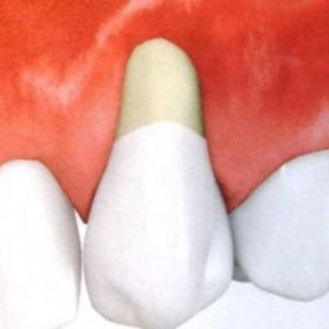 444744