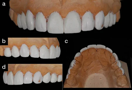 DIAGNOSTIC MOCK-UP 1