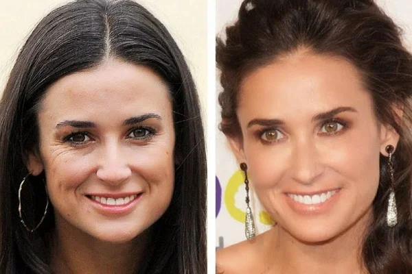 Demi_Moore_Plastic_Surgery_Before_After