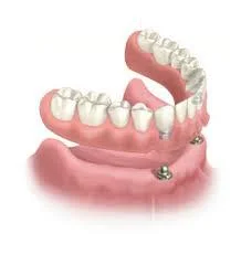Overdenture with ball