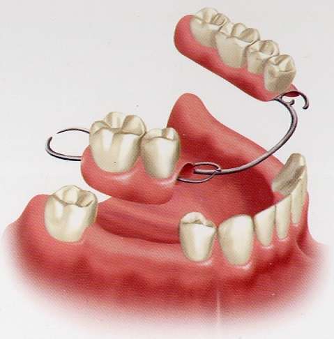 several-teeth-1